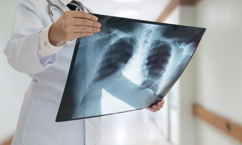 Laboratorios y Radiografia de Torax
